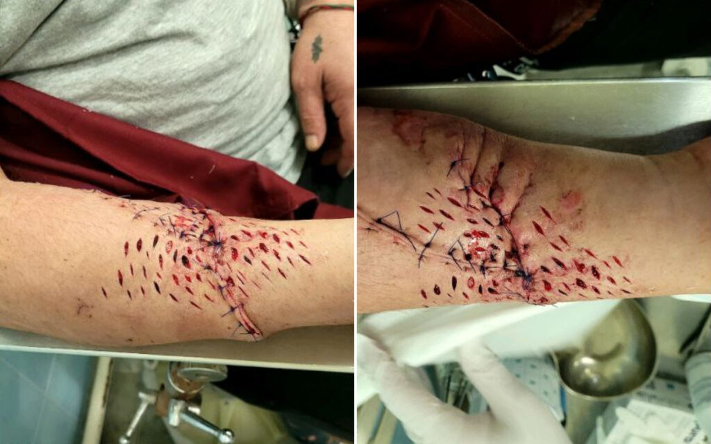 Збір для пораненого воїна Андрія Тарана