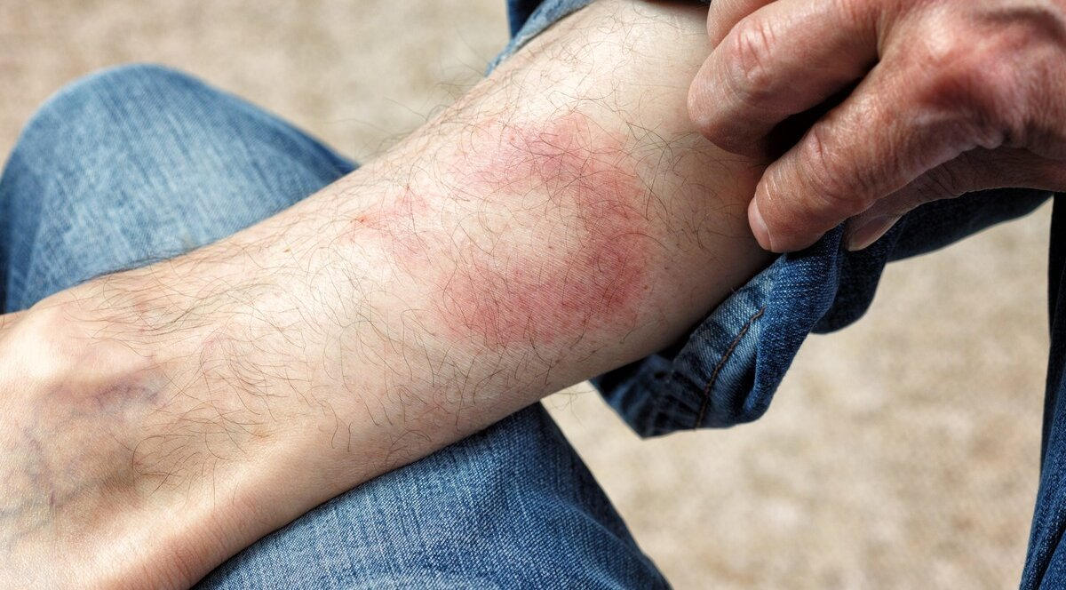 Ілюстративне фото