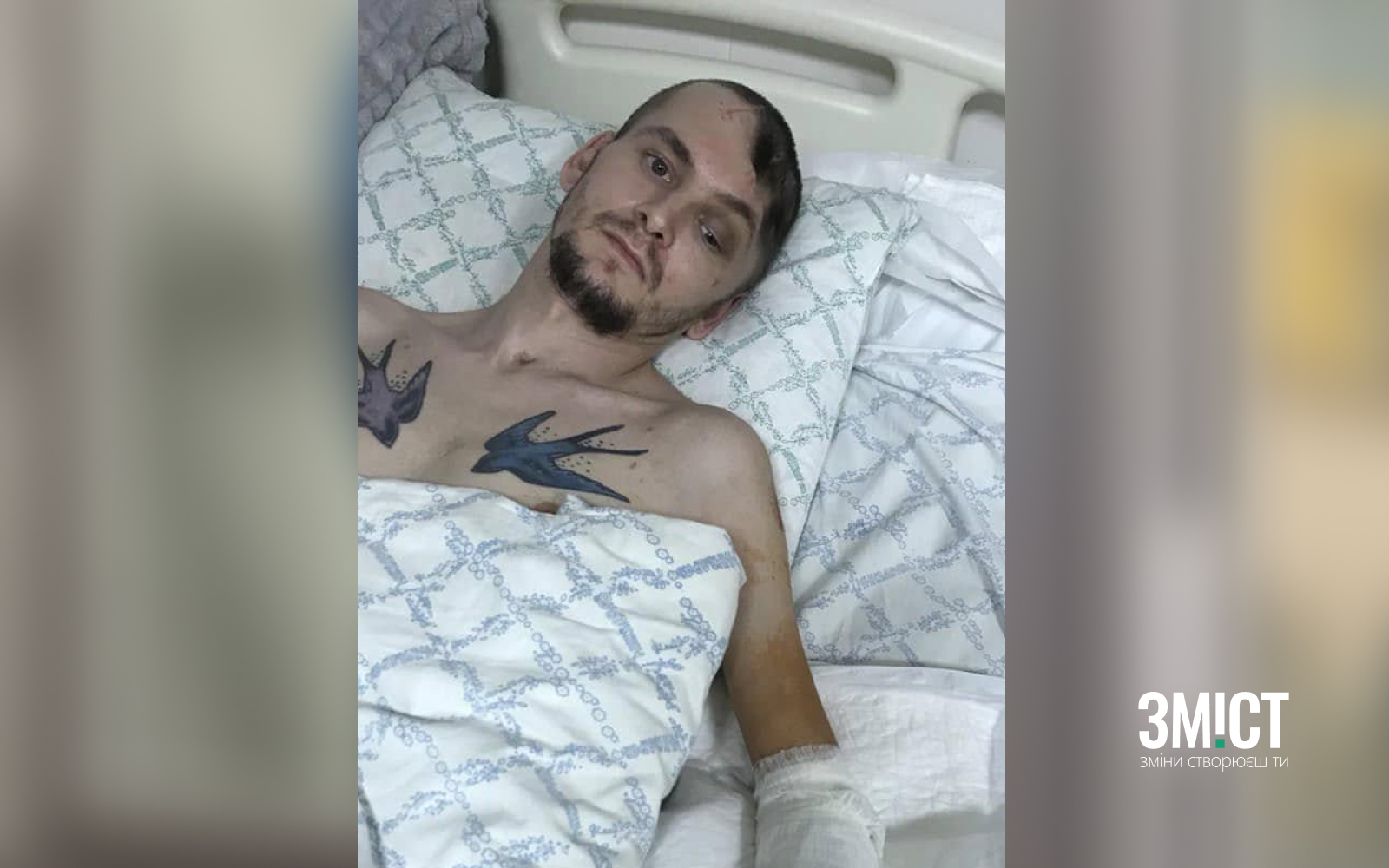 Ігор Тарас під час реабілітації